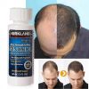 Kirkland Minoxidil 5% 60ml + 1 piece DRS Derma Roller